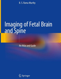 Imaging of Fetal Brain and Spine: An Atlas and Guide 1st ed. 2019 Edition, ISBN: 978-9811358432